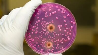 Patologinis vyrų išmetimas, kai jaudinasi